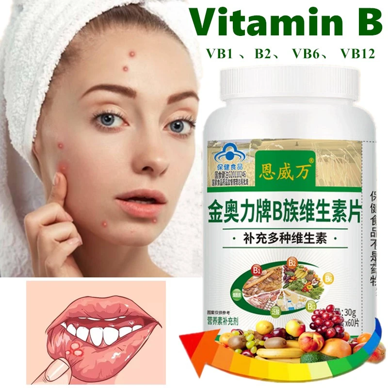 B vitamins Multivitamin supplement vitamin b b1 b2 b6 b12 Treat acne
