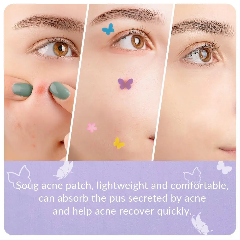 Butterfly Shape Acne Pimple Patch Stickers Blemish Spot Concealer Cover 0.1mm Acne Treatment Pimple Remover Skin Care