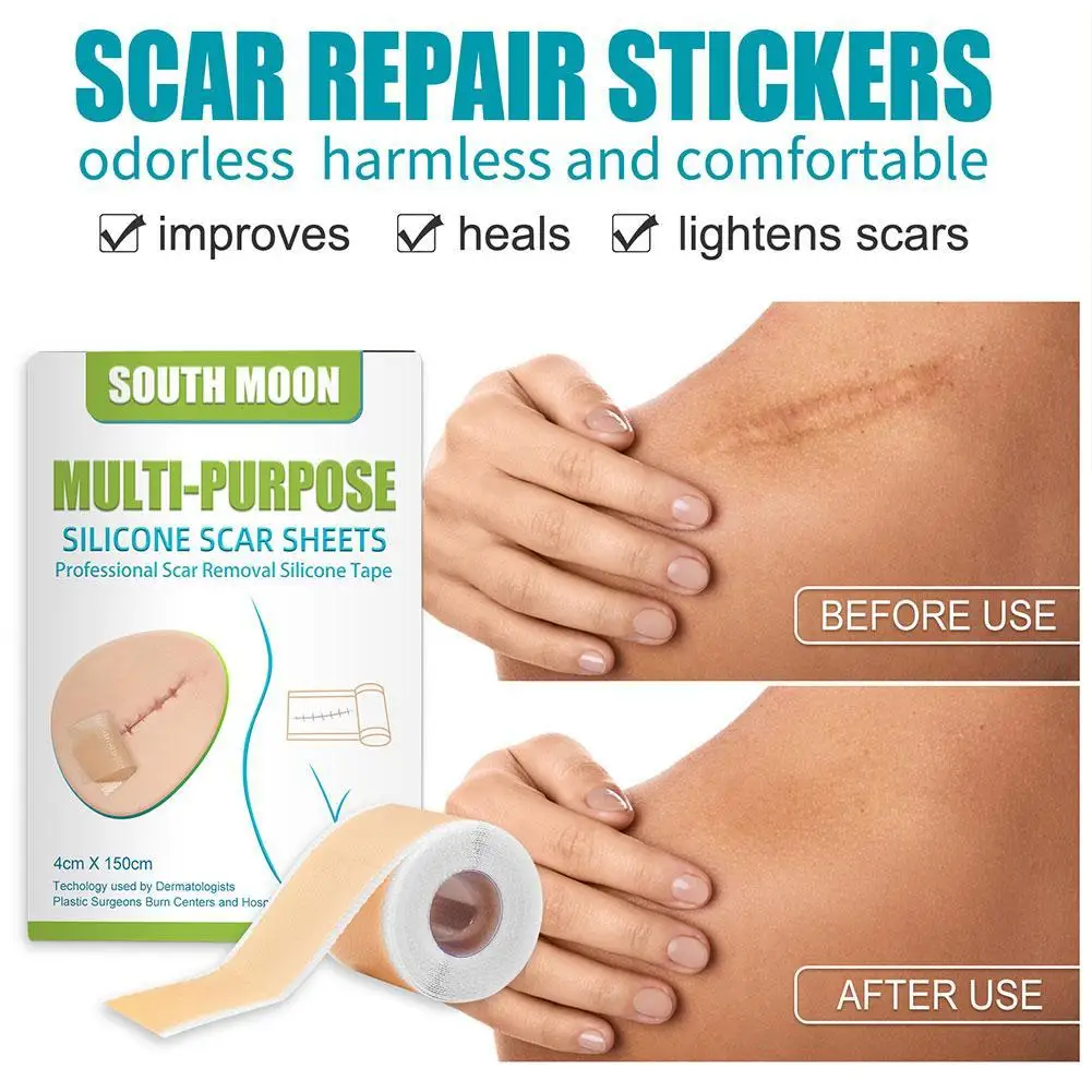 Silicone Surgical Scar Removal Patch Remove Trauma Burn Sheet Skin Repair Scar Removal Therapy Patch For Acne Treatment