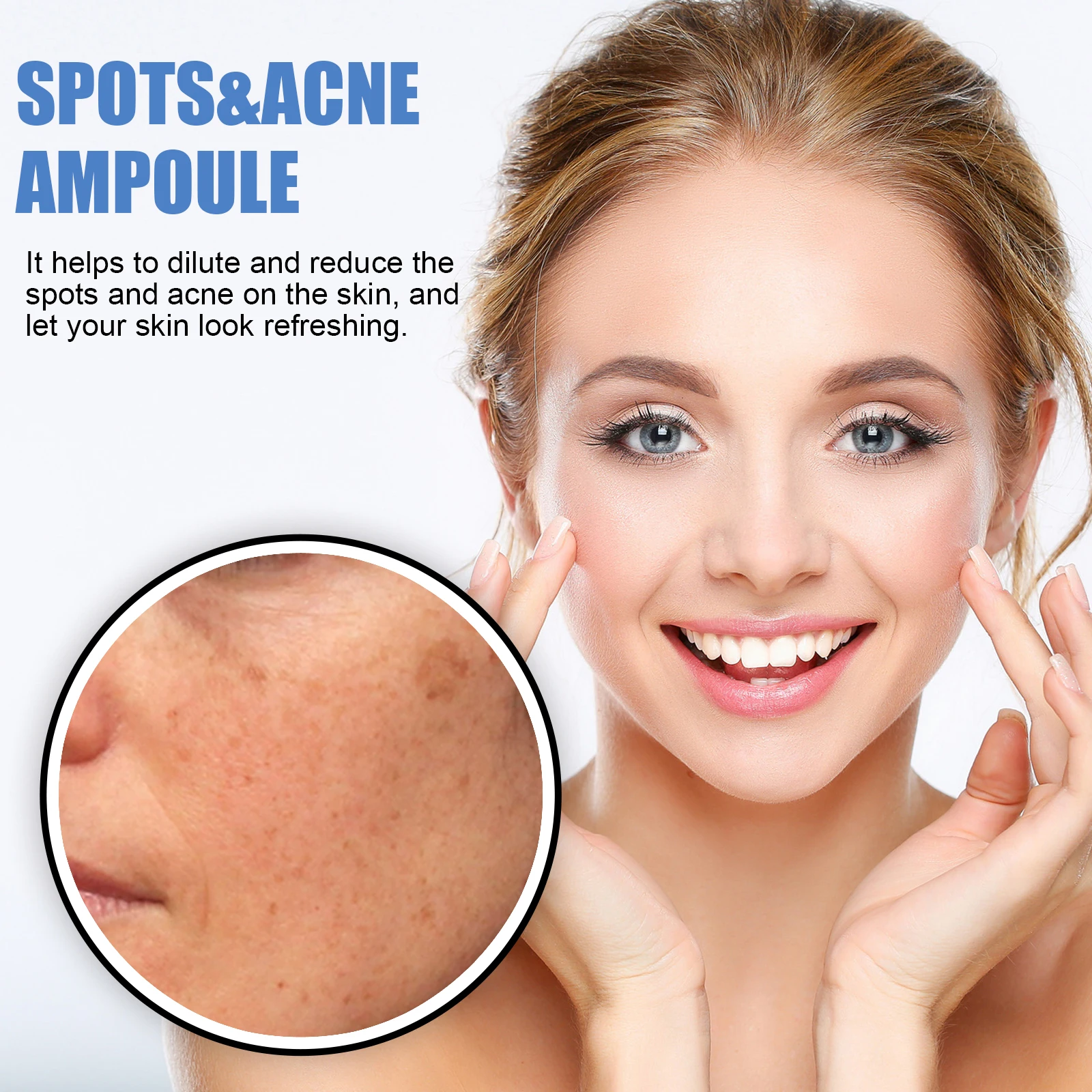 Hoygi Fast Results Dilute Reduce Spots And Acne Refreshing B5 Melasma & Dark Spots Moisturizing Skin Spots & Acne Ampoule 5