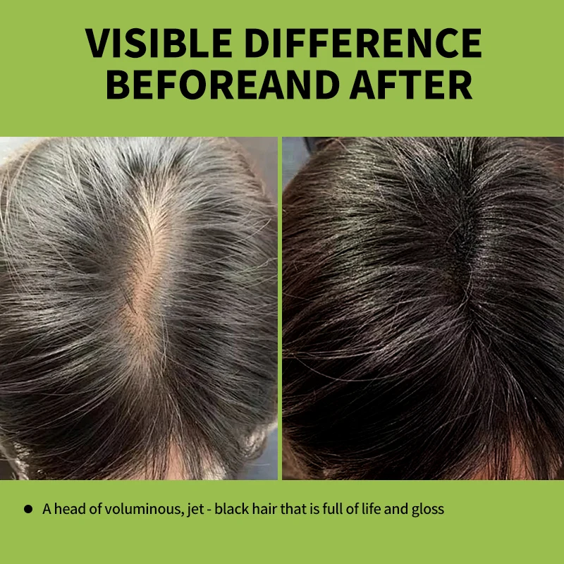 Shampoo colorante per capelli neri al rosmarino 500ml Shampoo colorante istantaneo per capelli a base di erbe fai da te da grigio a nero per donne e uomini - immagine 4