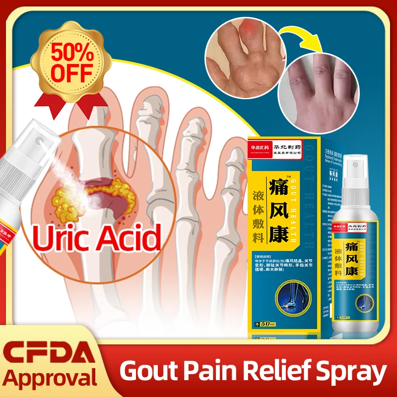 

Gout Pain Relief Medical Spray Uric Acid Medicine Finger And Toes Swelling Cream Arthritis Treatment Plaster Cfda Approval 50Ml