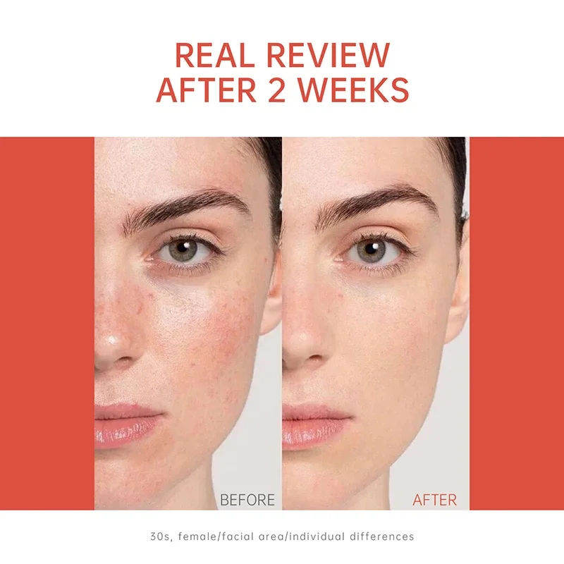 PDRN Salmon DNA Serum Ampoule Repair Renew Skin Brighten Tone Facial Essence Hydrating Nourishing Firming Skin Care Treatment - immagine 4