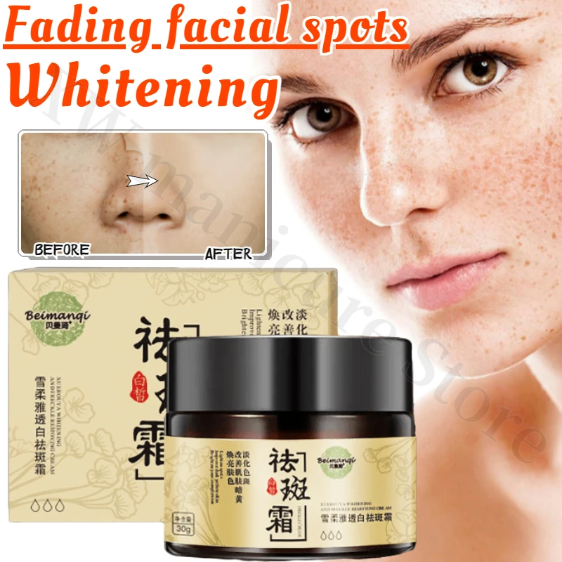 Whitening Freckle Cream Effective Remove Melasma Cream Remove Dark Spots Melanin Moisturize Brighten Smooth Face Skin Care vitamin c whitening freckles face cream remove melasma dark spots cream fade melanin moisturize brighten smooth beauty skin care