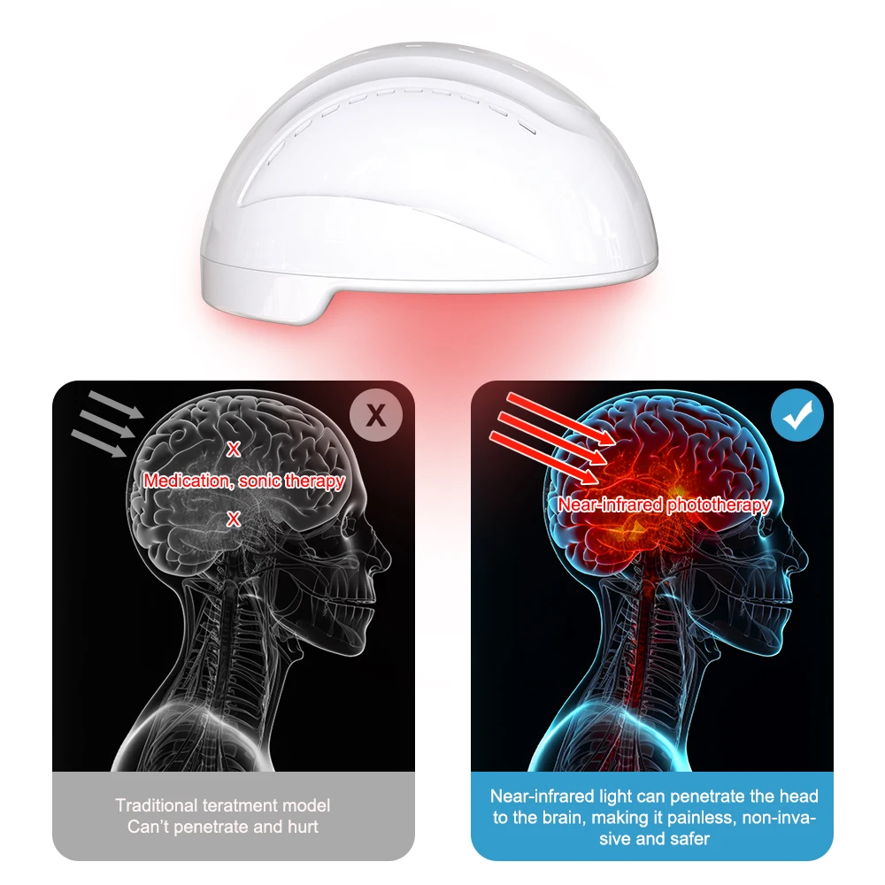 Physiotherapy 810nm Infrared Light Therapy Brain Helmet Relaxation Treatment Helmet for Autism Migraine Relief Parkinson 2023 2023 new eswt physiotherapy shockwave equipment