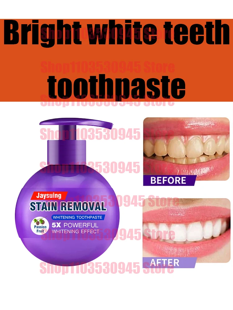 

Toothpaste Peroxide Whitening Toothpaste 100g Clean Mint Flavor Refreshing Breath Removing Tooth Stains