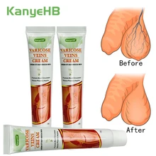 

3pcs Genital Scrotum Varicocele Remover Treatment Varicose Veins Cream Varicosity Angiitis Phlebitis Leg Veins Pain Removal A641