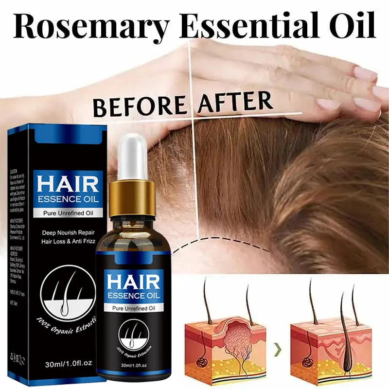 Hair Growth Oil Strengthen Anti Hair Loss Prevent Breakage Essential Massage Oil Effective Help Growth Hair&Scalp Care