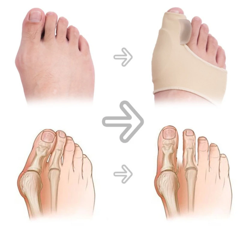 Toe Separators 1Pair Toe Separator Hallux Valgus Bunion Corrector Orthotics Feet Bone Thumb Adjuster Correction Pedicure Sock Straightener