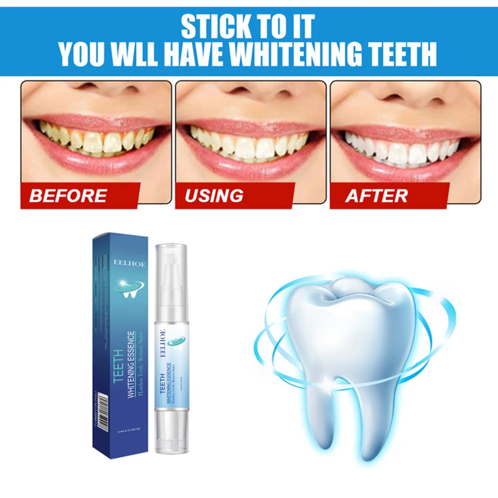 Teeth Whitening Pen Whitener Bleach Essence Gel Remove Plaque Stains Instant Smile Tooth Cleaning Serum Kit Beauty Health teeth whitening gel teeth whitening kit