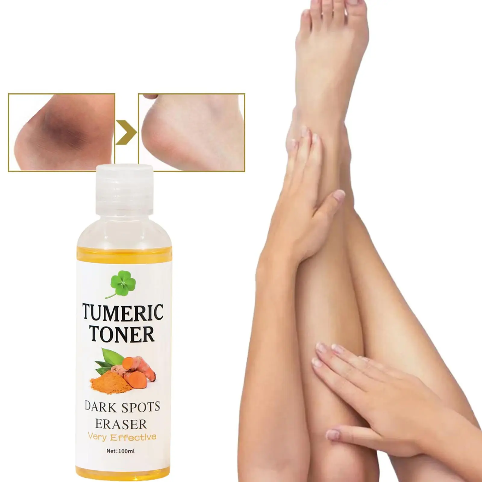 

100ml Tumeric Dark Spots Toner Spots Eraser Corrector Turmeric Fade Blemishes Dark Spot Remover Acne Remover Toner for Dark T9J9