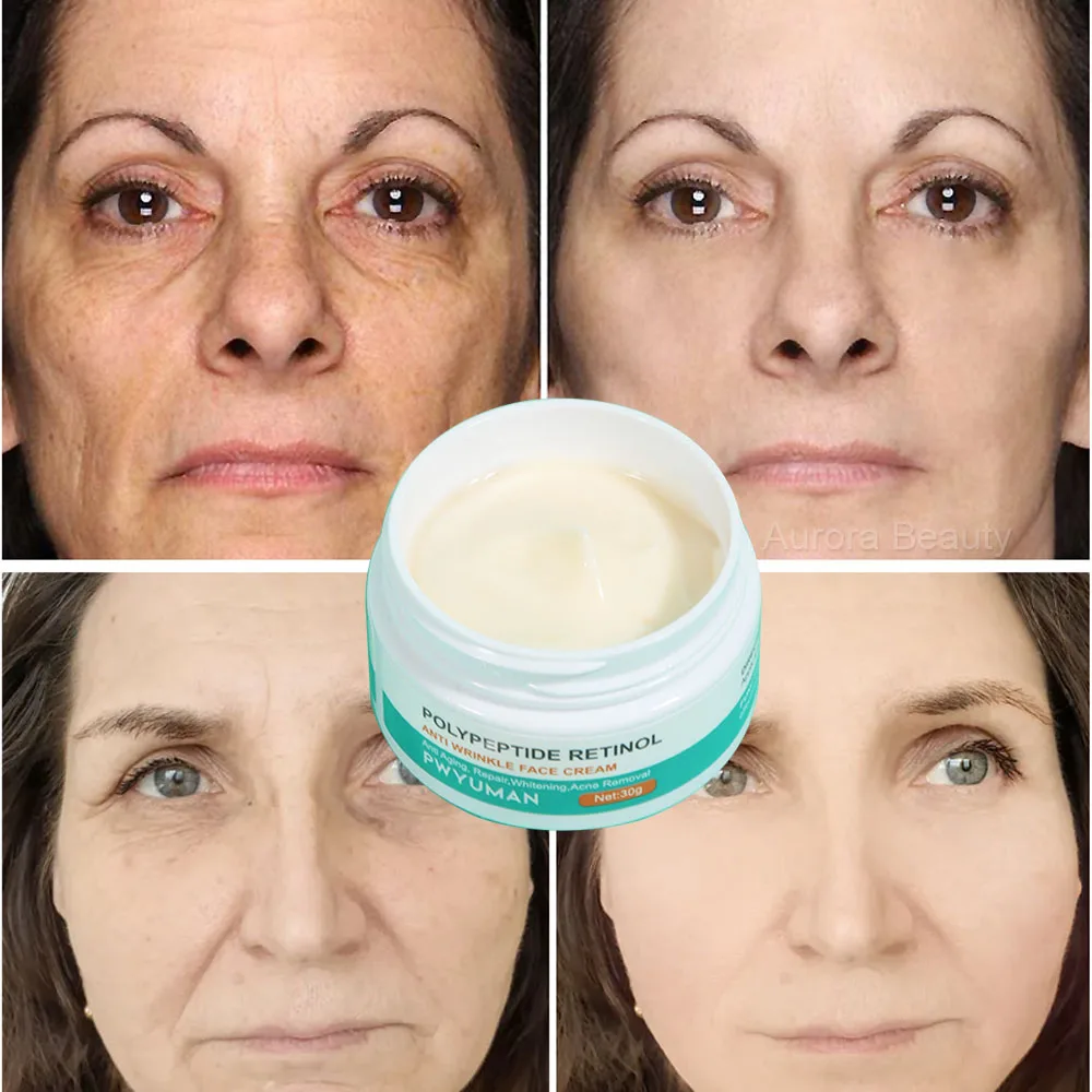 Retinol Remove Wrinkle Face Cream Lifting Firming Fade Fine Line Anti-aging Whitening Moisturizing Korean Skin Care_voghion.com