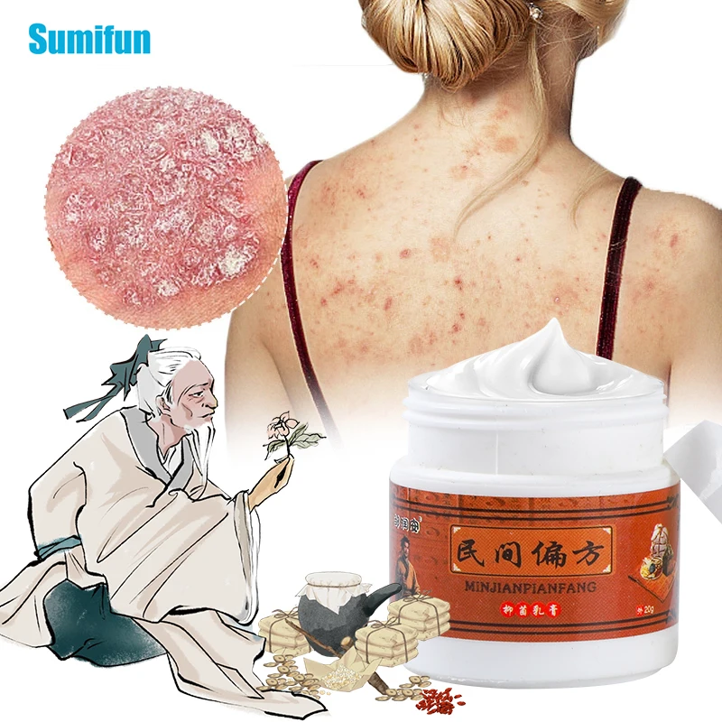 

20g Antibacterial Psoriasis Cream Herbal Medicine Anti-itch Relief Dermatitis Eczema Treatment Urticaria Desquamation Skin Care