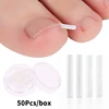 50pcs Ingrown Toenail Correction Tool Invisible Ingrown Toe Nail Treatment Pad Groove Straightening Clip Brace Foot Care Tool 1