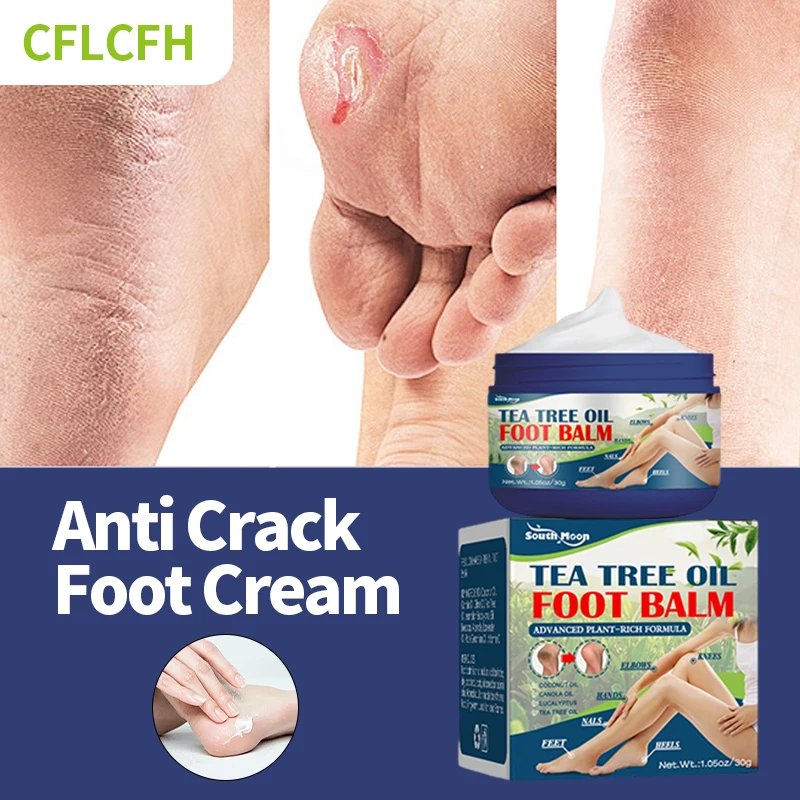 

Anti Crack Foot Cream Peeling Drying Cracked Feet Repair Hand Heel Dead Skin Removal Foot Care Moisturizing Emollient Ointment