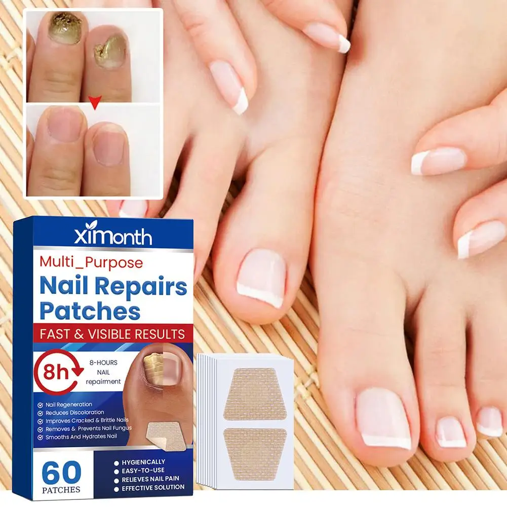 Nail repair stickers