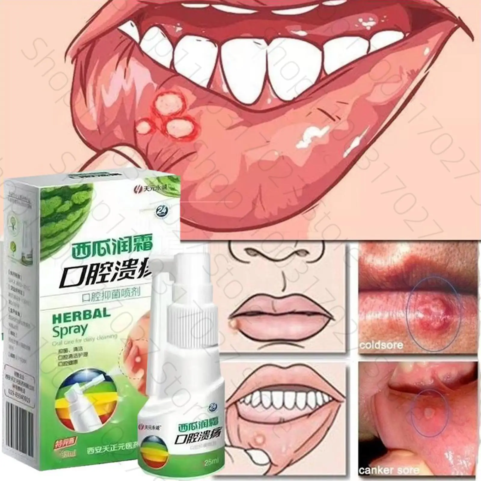 Herbal Oral Spray Watermelon Cream Antibacterial Spray Ulcer Pain Relief Spray Antibacterial Treatment Health Care Fresh Breath