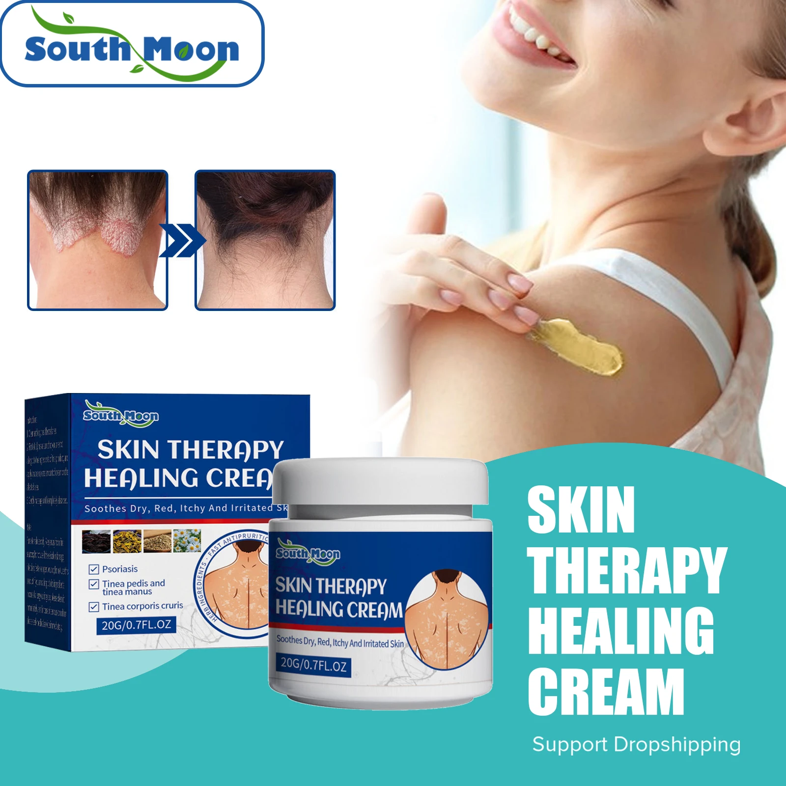 South Moon Healing Skin Cream Psoriasis Antiitch Ointment Eczema