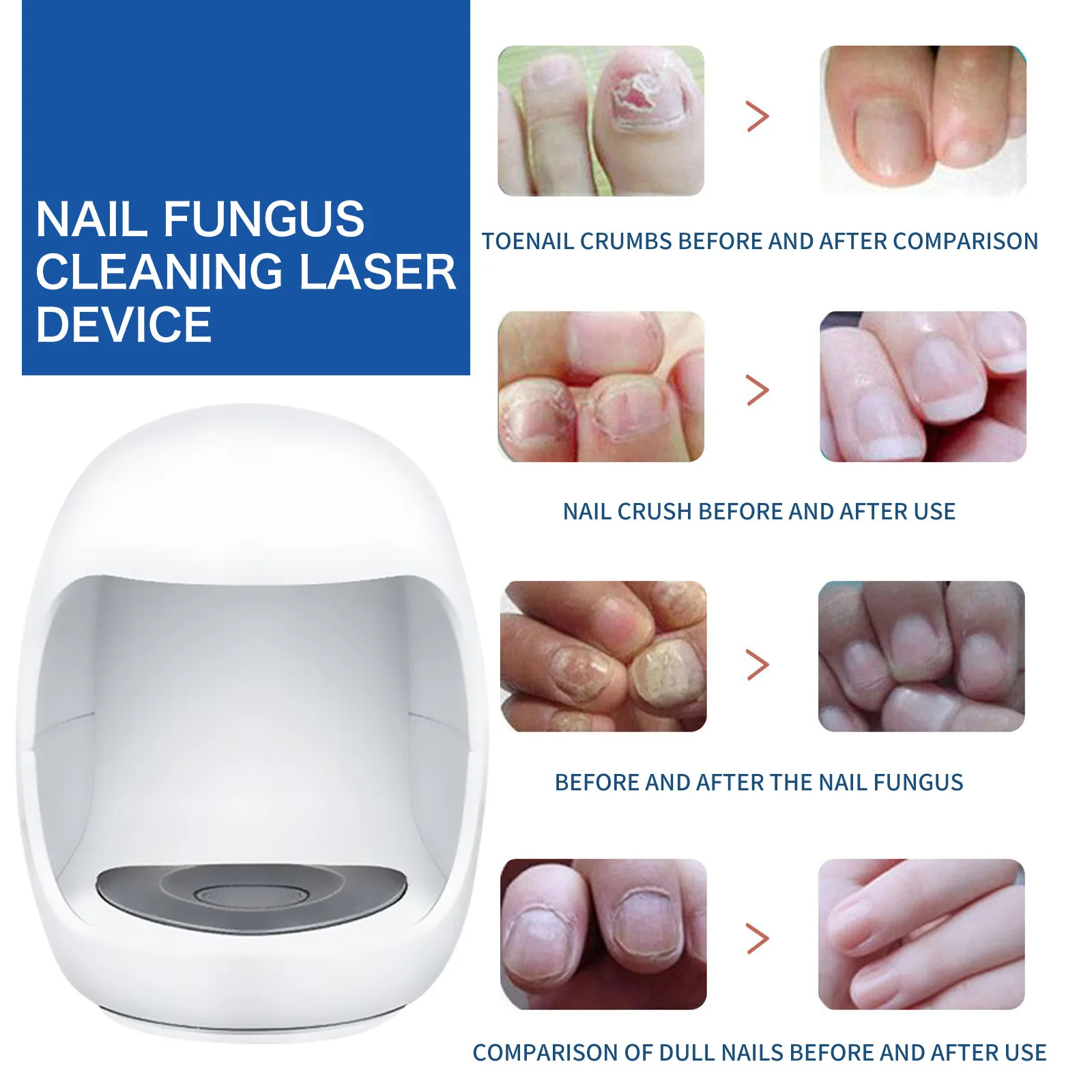 Nail Repair Equipment Nail，nails，pedicure，spa，Nail repair equipment
