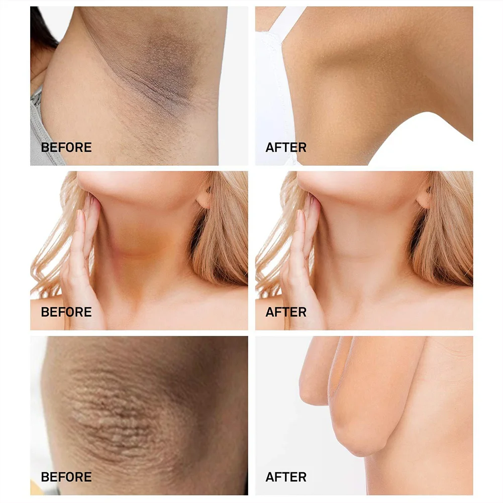 Vova Dark Spots Cream Whitening Cream Underarms Melanin Reduction Black Lines Fade Spots Whitening Skin Care