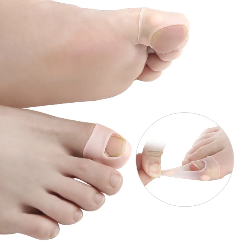 1Pair Gel Silicone Ingrown Toenail Correction Invisible Ingrown Toe Nail Straightening Clip Brace Treatment Foot Care Tools