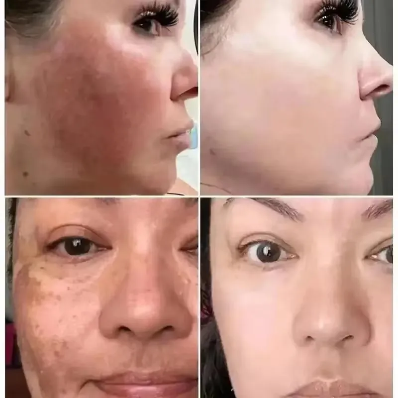 Vitamin C Whitening Serum Remove Freckles Dark Spots Face Essence Fade Melasma Melanin Brighten Repair Dull Skin Care Cosmetics 4