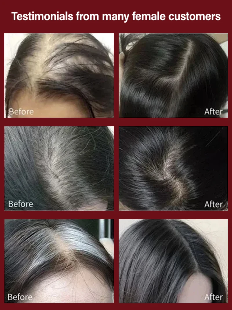 Hair Massage Comb Laser Comb Hair Loss Reduction Massage Relaxing Scalp Home Use Tangled Brush