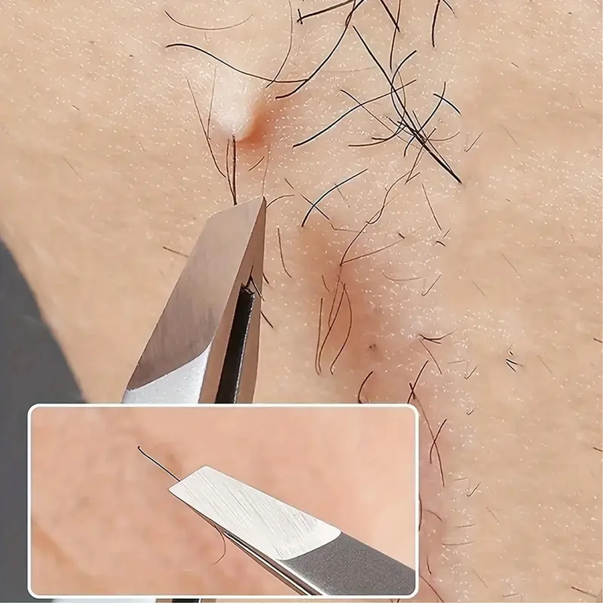 1/3/5/10PCS 고품질 스테인레스 스틸 눈썹 클립 제모 펜치 족집게 수염 제거 특수 비스듬한 입 클립 오렌지