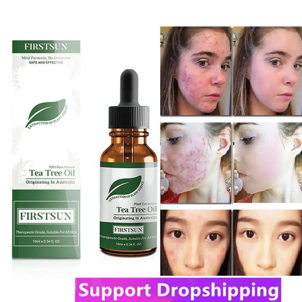 

100% Natural Tea Tree Essential Oil Anti-wrinkle Extract Acne Organic Massage Treatment Oils Removal Scars M1H7