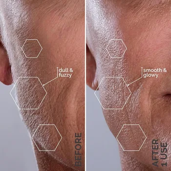 Michael Todd Beauty - Sonicsmooth – SONIC Technology Dermaplaning Tool - 2 in 1 Women’s Facial Exfoliation 4