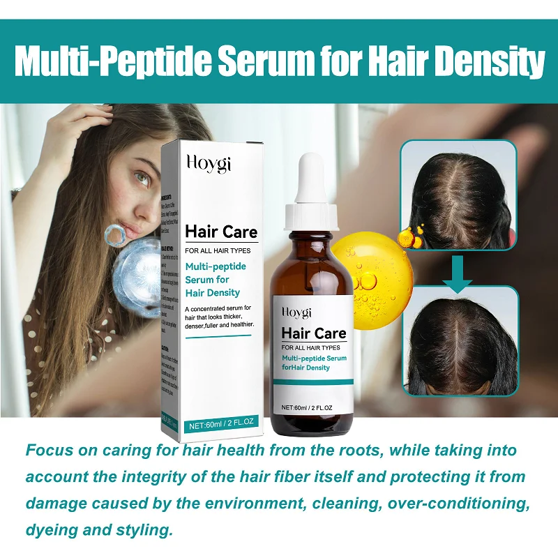 

Dense Hair Essence Hair Anti-Fall Strong Hairs Fixation Thick Nourishing Hairs Root Hairs Scalp Massage Promotes Hair Growth