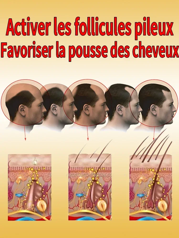 Anti Hair Loss Spray 10ml for Hair Growth