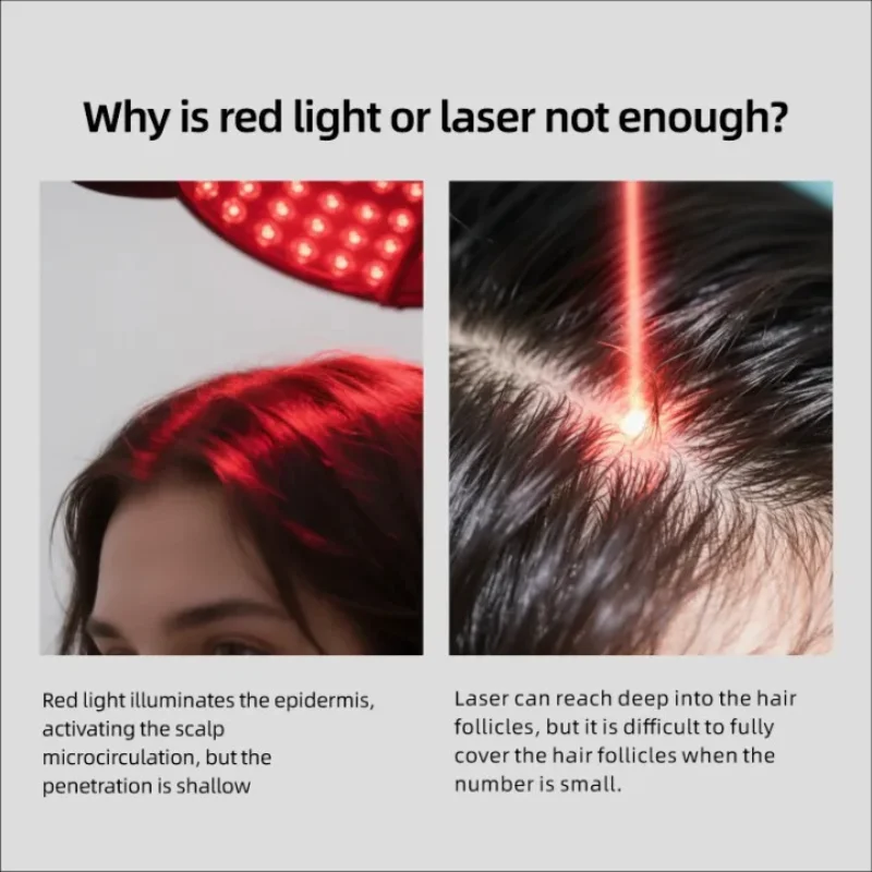 Advanced Red Light Therapy Hair Cap - Laser Treatment Hat Stimulates Follicles & Accelerates Hair Growth