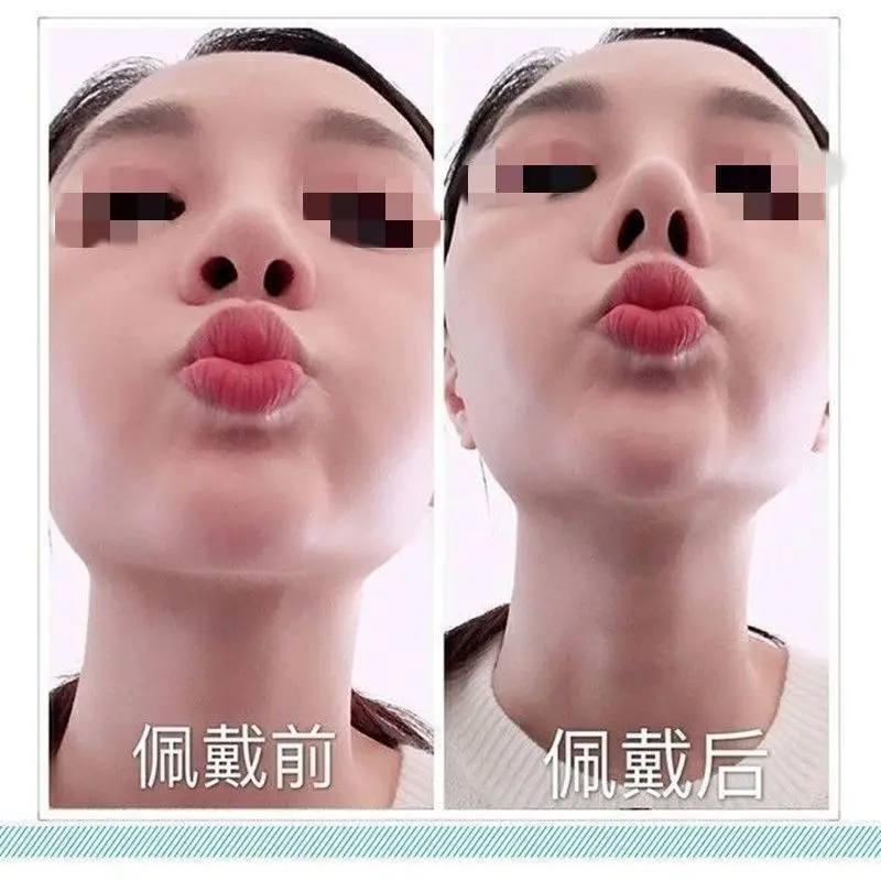 Invisible Noses Upturned Beautiful Nose Pad Nose Straightener Reduced Wing Noses Clips 2