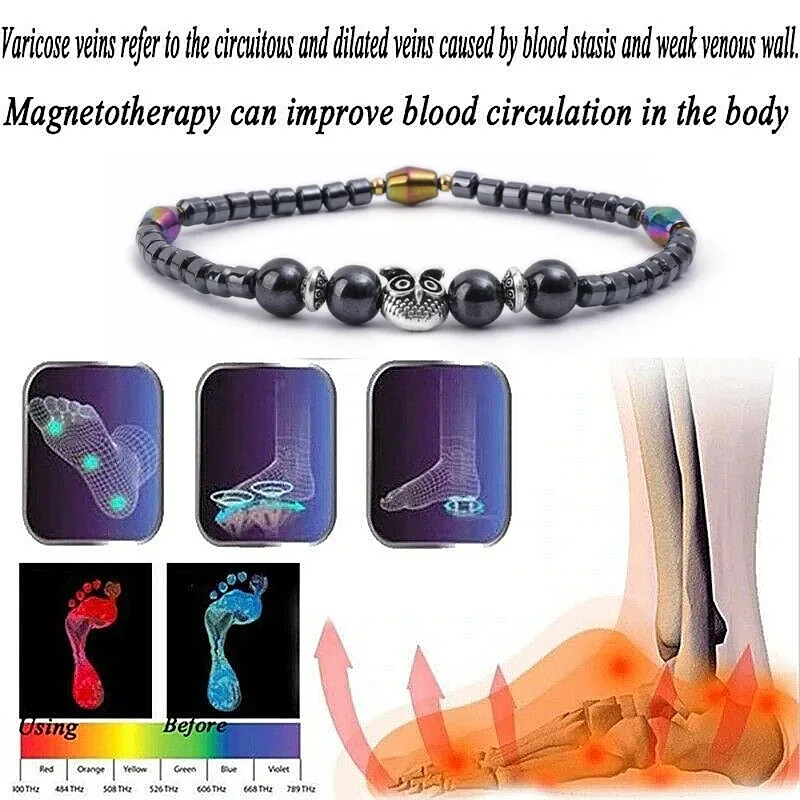 Ankle Chains Molded Slimming Magnetic Therapy Health Magnet Ankle Chains Relieve Fatigue Weight Loss Magnet Anklets Natural Stones Bracelets