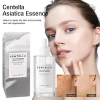 SKIN1004 Centella Asiatica Serum Korean Centella Toner Brightening Skin Moisturizing Water, Face Care Serum for all skin types