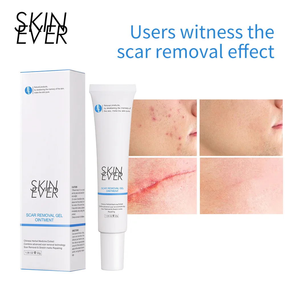 

Skinever Acne Face Herbal Pimple Scar Removal Shrink Pore Oil Control Moisturizing Facial OINTME Gel Acne Treatment Skin Care