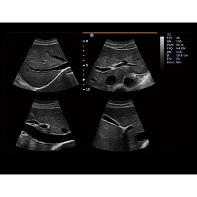 Рисунок 3 - CHISON Ebit 30, медицинские ультразвуковые инструменты