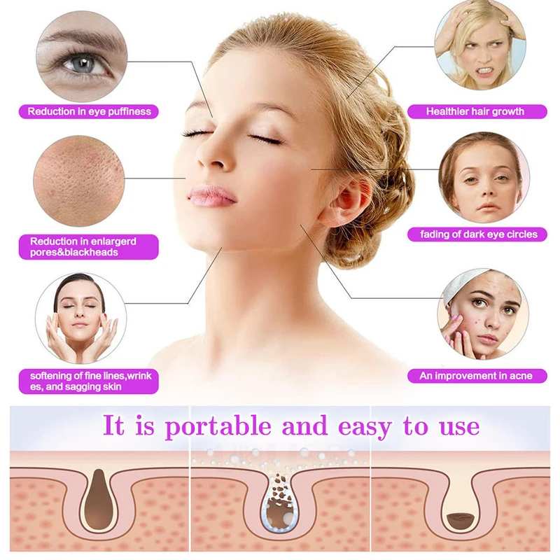 Professional Treatment Facial High Frequency Ozone Therapy Wand With Anti-Aging Skin Tightening Dark Circles Scalp Stimulator 3
