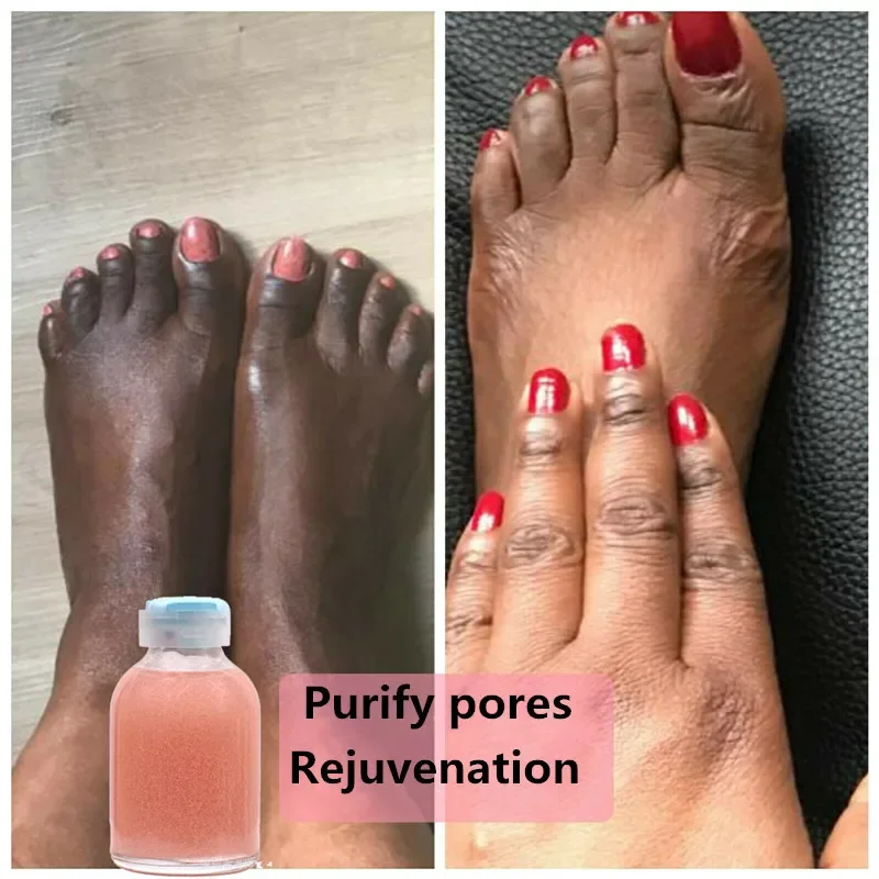 

30ml Face Serum Strong Hand and Feet Lightening Whitening Cleasing Serum Clean Up Dark Knuckles Melting and Brightening Skin