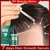 7 Days Ginger Hair Growth Serum Fast Promote Hair Regrowth Products Anti Hair Loss Repair Scalp Baldness Nourish Hair Root Care