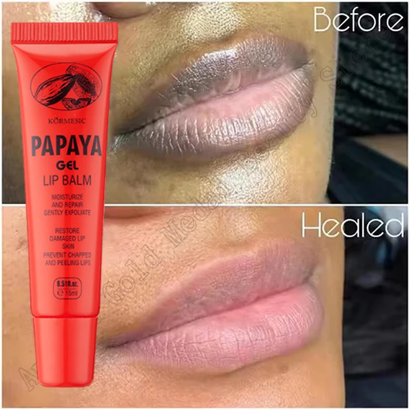 Remove Dark Lip Balm Lightening Pink Lip Exfoliating Fade Line Dead Skin Moisturizer Korean Care Products lip balm