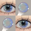 DR 14.2mm