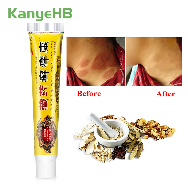 

1pcs Psoriasis Cream Relief Eczema Dermatitis Ointment Antibacterial Itching Herbal Essence Tibetan Medicine Health Care S050
