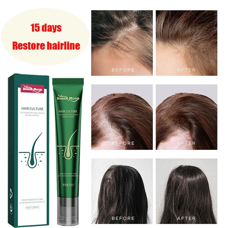 

Ginger Hair Growth Product Anti-loss Hair Regrowth Serum Oil Fast Grow Prevent Baldness Treatment Alopecia Men Women Hair Care