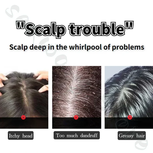 شامبو ديركوس لتنظيف فروة الرأس بعمق – للتحكم في الزيوت، تهدئة الشعر التالف، ترطيب وتنعيم العناية بفروة الرأس – 200 مل 4