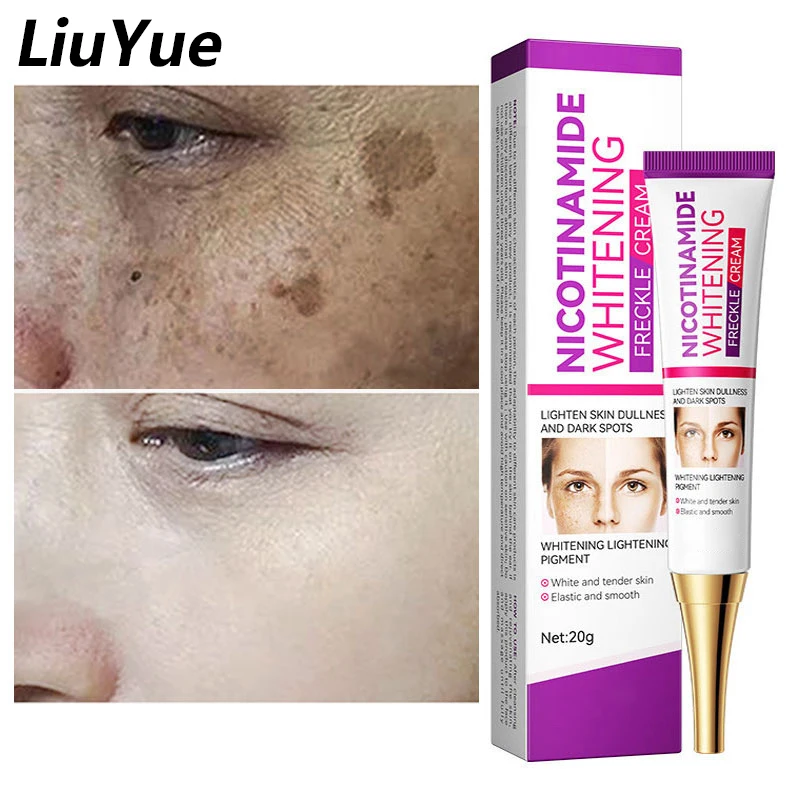 

Niacinamide Facial Freckle Cream Whitening Remove Acne Marks Melanin Cream Fade Dark Spots Melasma Brightening Face Skin Product