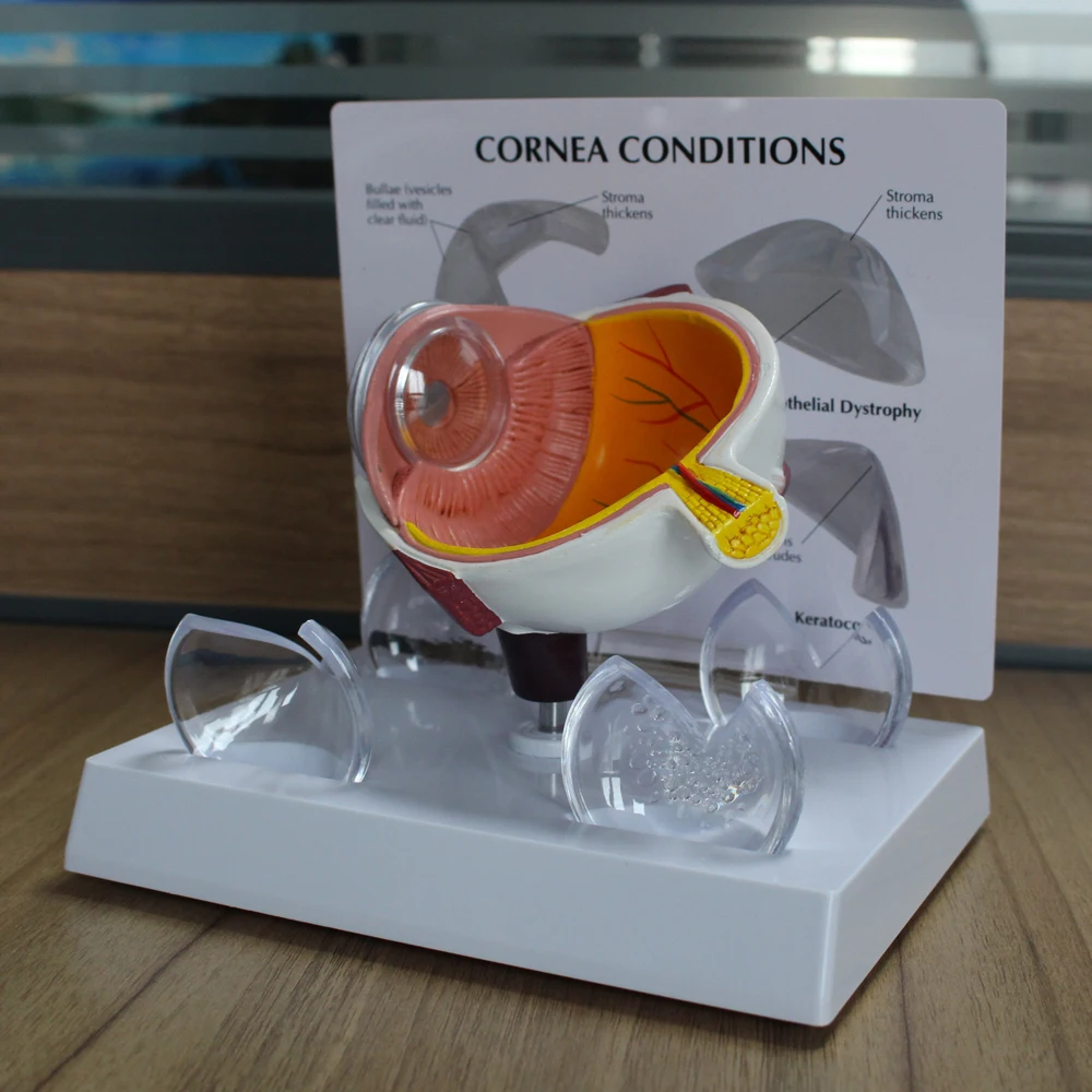 Cornea Eyeball Model Human Eye Demonstration Glaucoma Cataract Anatomy Medical Teaching Tool