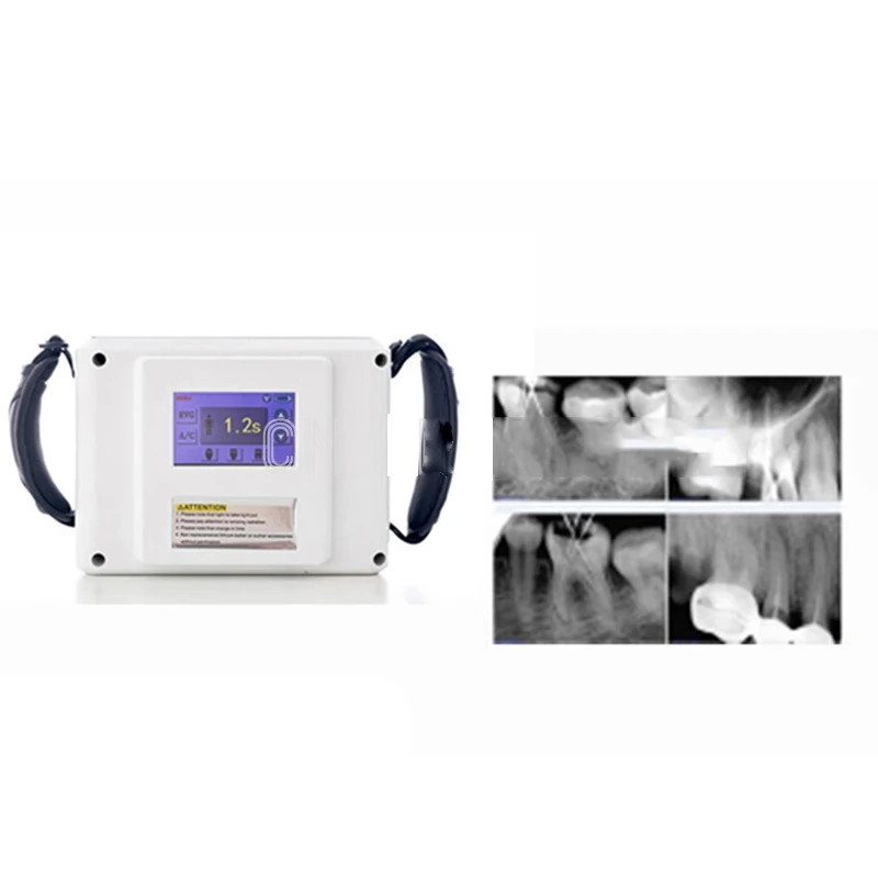 Рисунок 4 - Цифровой стоматологический рентгеновский аппарат