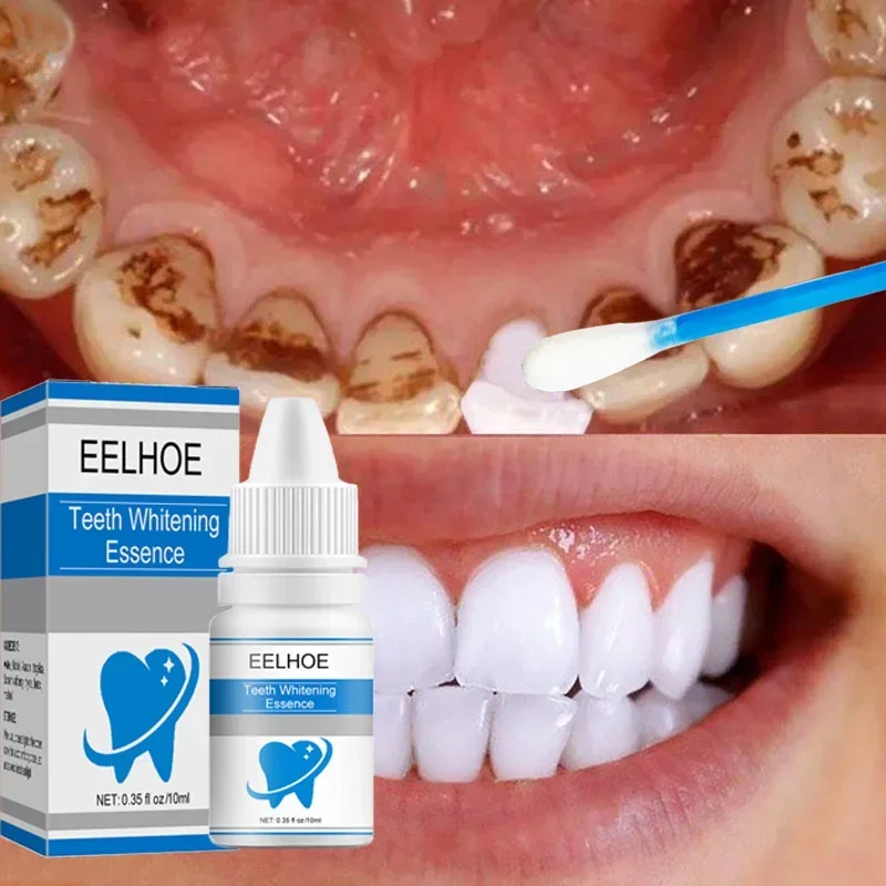 EELHOE Teeth Whitening Essence Remove Plaque Stains Oral Hygiene Bleaching Products Cleansing Fresh Breath Dentistry Care Tools